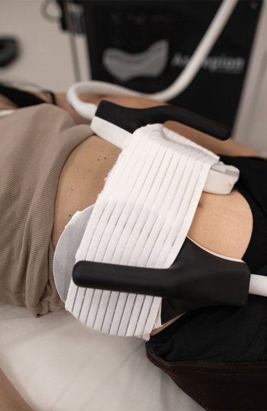 Косметолог проводить процедуру BodyLab для моделювання тіла