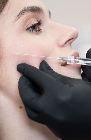 Косметолог виконує інʼєкції під час контурної пластики скул