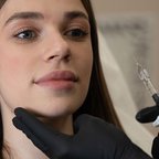 Косметолог виконує інʼєкції під час контурної пластики обличчя