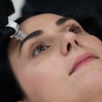 Косметолог проводить апаратну чистку обличчя