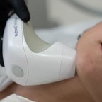 Косметолог проводить процедуру неінвазивного RF-ліфтингу обличчя