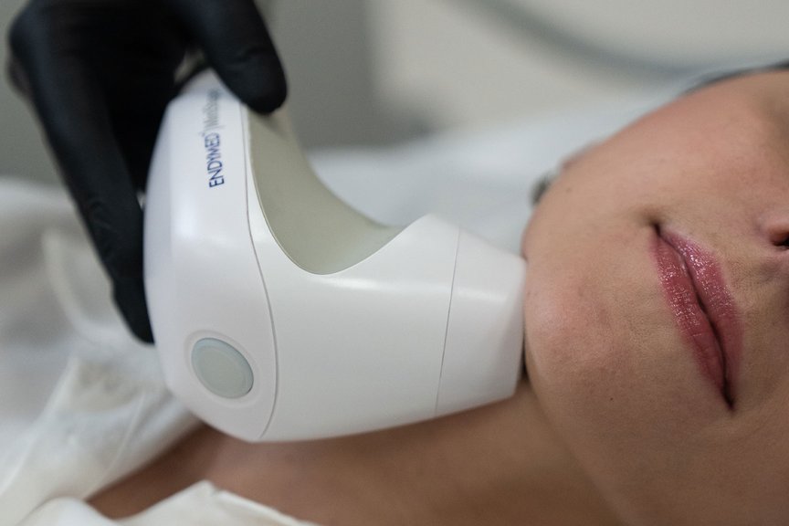 Косметолог проводить процедуру неінвазивного RF-ліфтингу обличчя