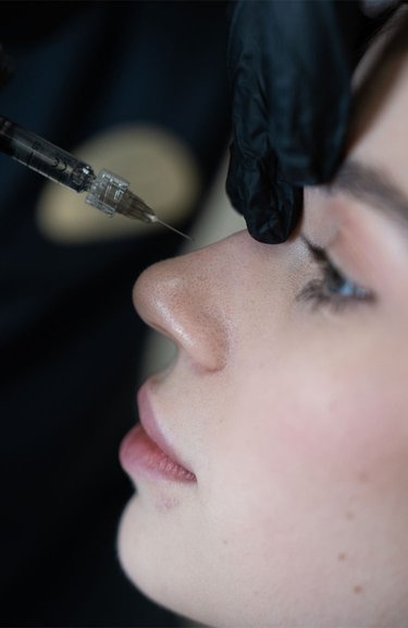 Косметолог виконує інʼєкції під час контурної пластики носа