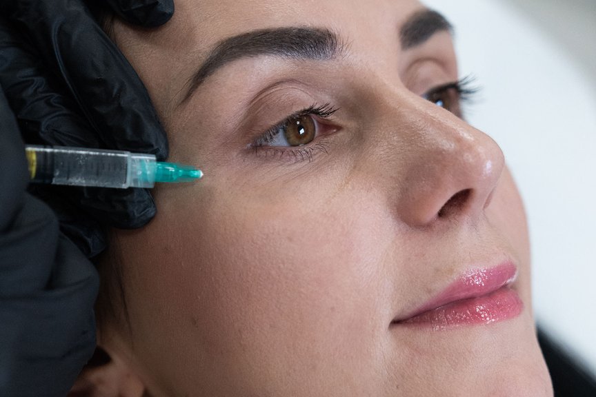 Інʼєкційна процедура для зволоження та омолодження шкіри