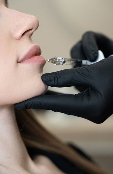 Інʼєкційна процедура для покращення форми губ