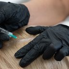 Інʼєкційна процедура для зміцнення волосяних фолікулів