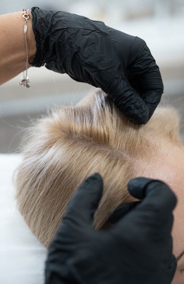 Прийом трихолога — аналіз причин випадіння волосся