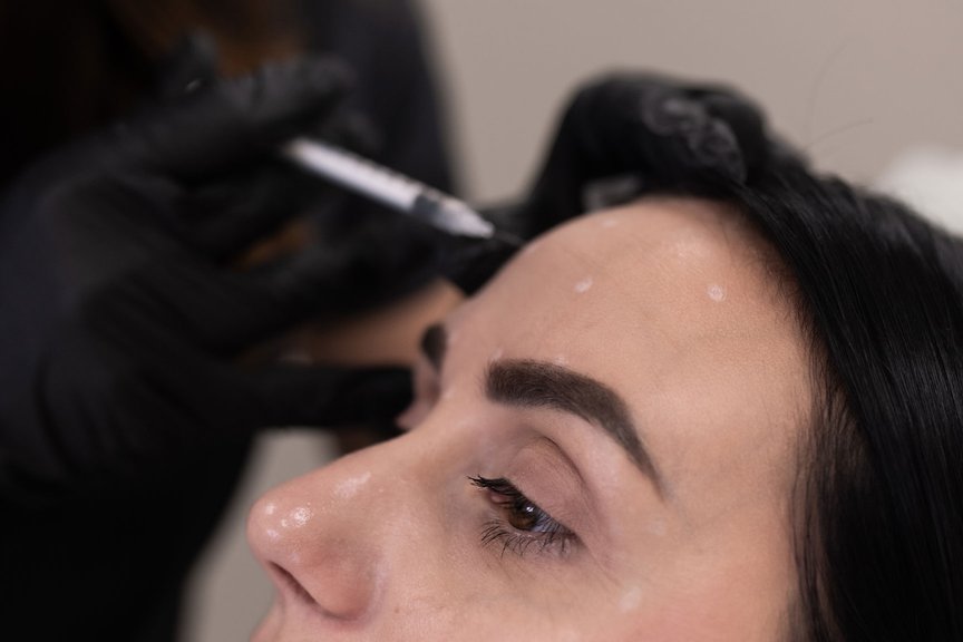 Ботулінотерапія — корекція зморшок, робота косметолога крупним планом