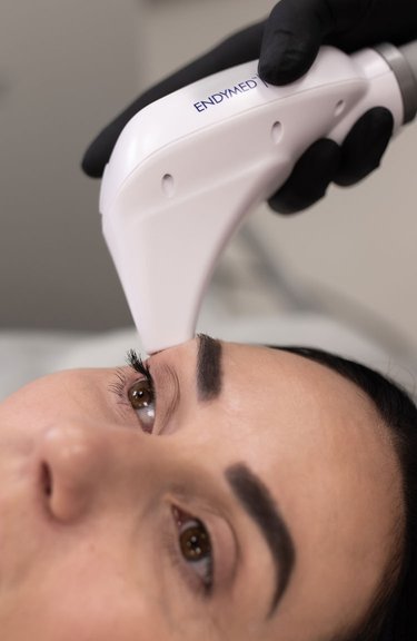 Корекція зони навколо очей — робота косметолога крупним планом