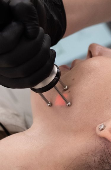 Лазерне шліфування обличчя — робота косметолога крупним планом