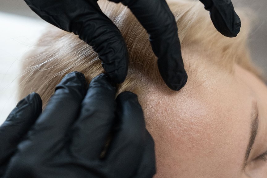 Консультація трихолога — обговорення діагностики та плану лікування