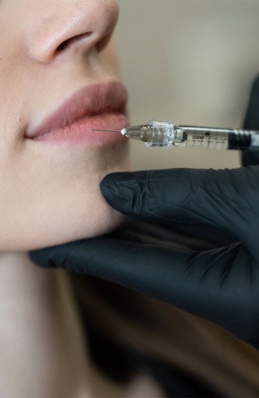 Контурна пластика губ